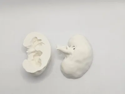 Left Kidney anatomical model (CT Scan)