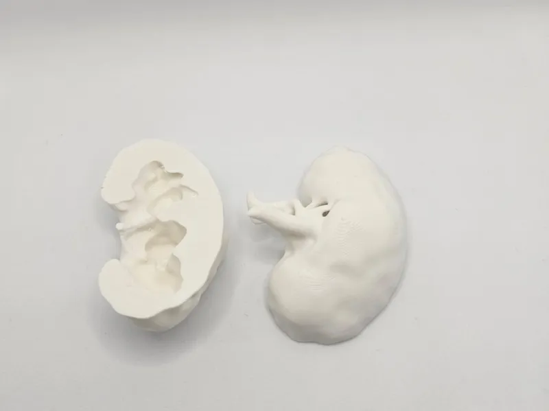 Left Kidney anatomical model (CT Scan)