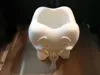 0.28mm layer, 2 walls, 15% infill