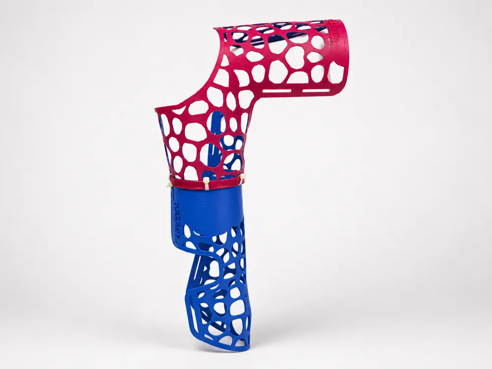 Adult Thermoformed Brachiopalmar Splint
