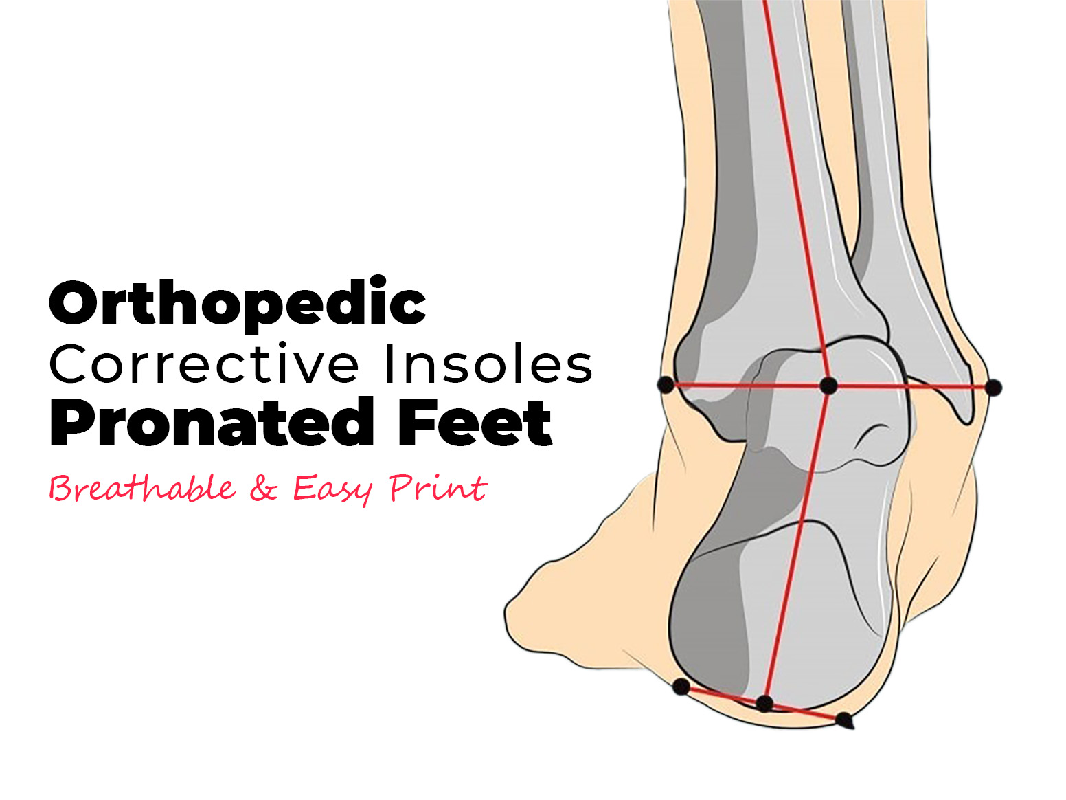 Pronation Orthopedic Corrective Breathable Insole