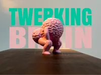 0.16mm layer, 3 walls, 15% infill