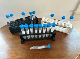 Test tube racks for 15mL 17x120mm conical tubes
