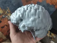 0.2mm layer, 5 walls, 1% infill