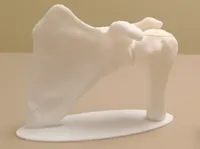 0.4mm layer, 2 walls, 15% infill