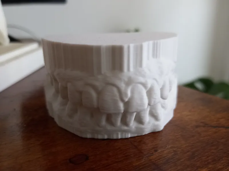 Arco dental real para protesis