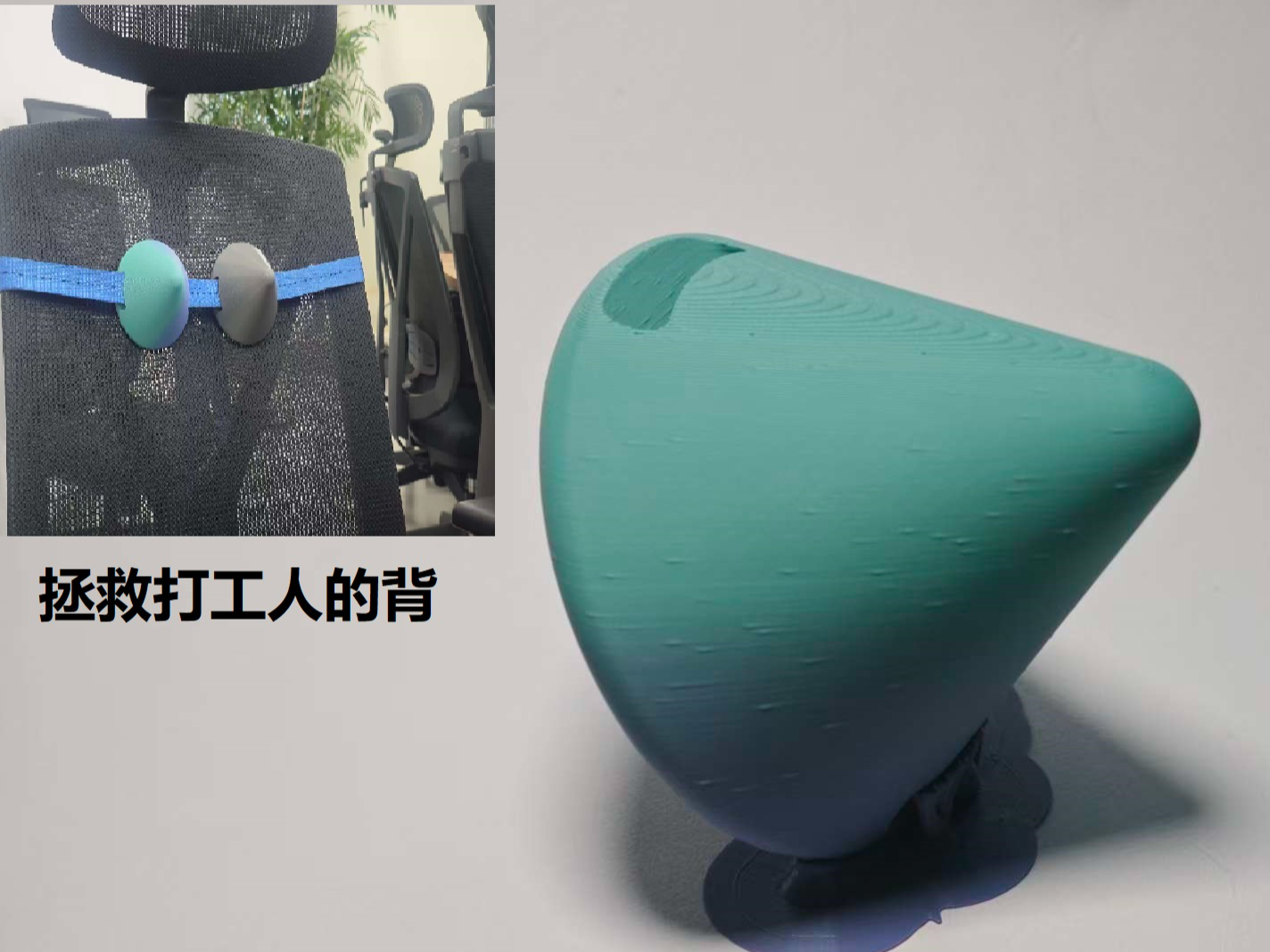 肩胛筋膜撕裂者