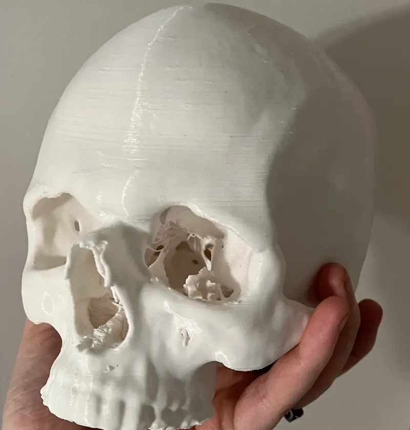 Human Skull (my OWN skull from a CT scan)