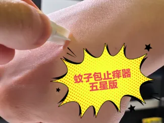 蚊虫叮咬止痒器—五星版(仅需2g)
