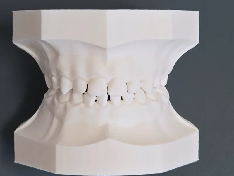 Primary Dentition Typodont – Class I Ideal