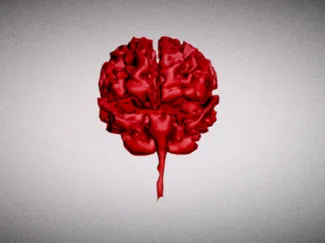 Brain with Alzheimer's