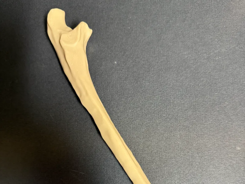Ulna with more supports