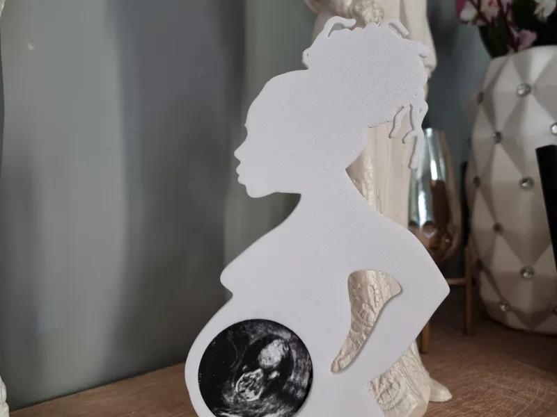 Ultrasound Picture Frame Dreadlocks