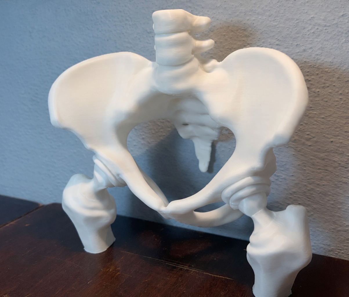 Miniatura 1 do modelo 3D Bilateral Hip Prosthesis