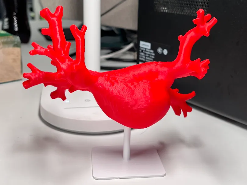Pulmonary Vein Medical Anatomy Educational Model by Zoom MakerWorld ...