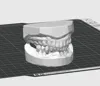0.2mm layer, 2 walls, 7% infill