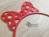 0.2mm layer, 2 walls, 5% infill