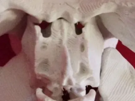 Ethmoid