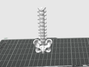 Columna Lumbar