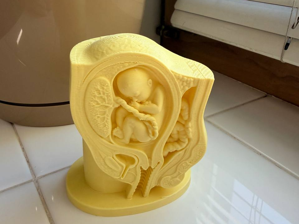 Pregnancy Anatomy Cross-Section – Fetus in Utero - 1