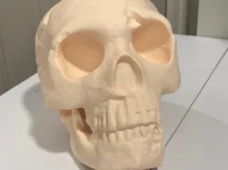 Neanderthal Skull