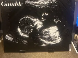 Ultra Sound for Sara