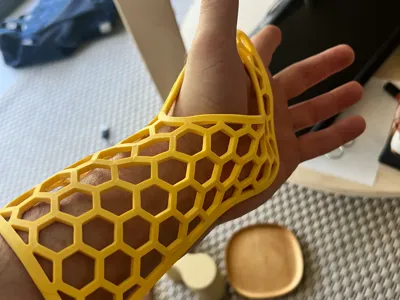 splint for broken bone