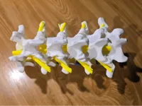 0.2mm layer, 2 walls, 10% infill