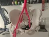 0.2mm layer, 3 walls, 10% infill