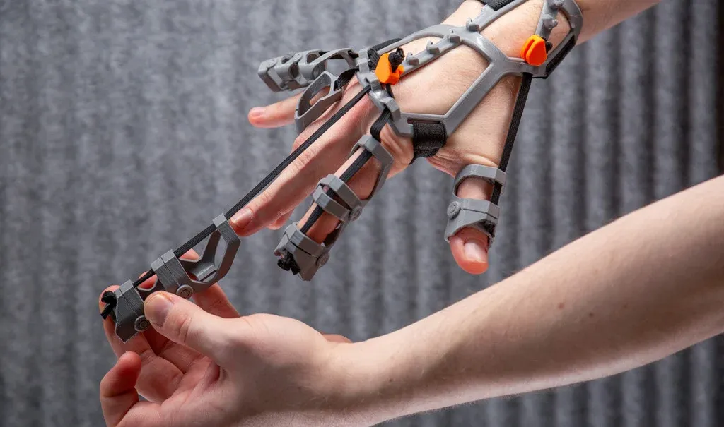 Improving fine motor skills, 3D printed orthosis view 2