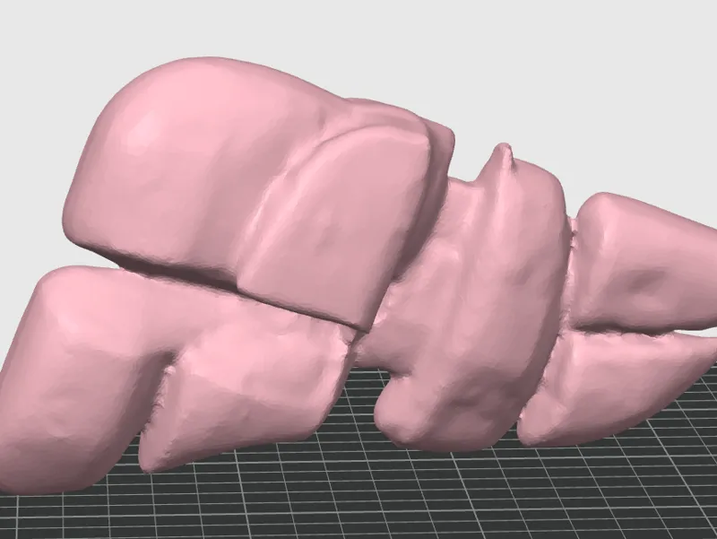 liver