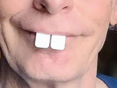 Fake rabbit teeth