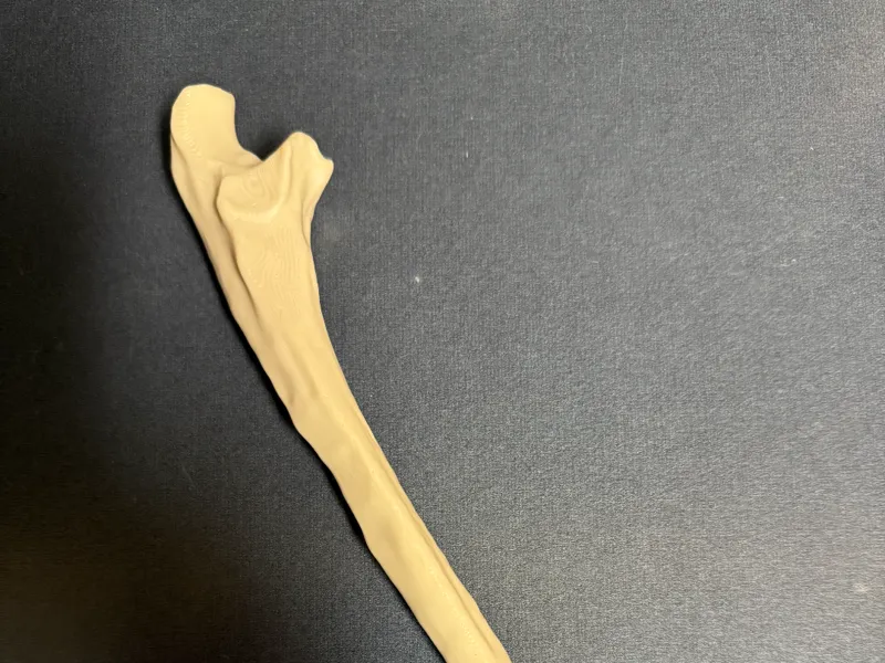 Ulna additional supports
