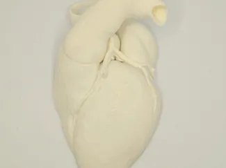 Sezione cuore anatomico (da Cardio-TC)