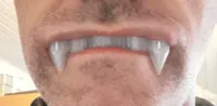 Fausses dents de vampire — photo 4