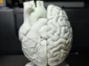 0.2mm layer, 2 walls, 4% infill
