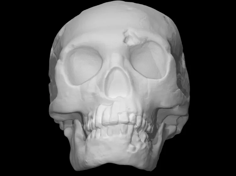 Neanderthal skull