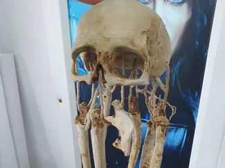 Wind Chime of Death