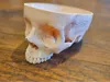 0.15mm layer, 2 walls, 7% infill