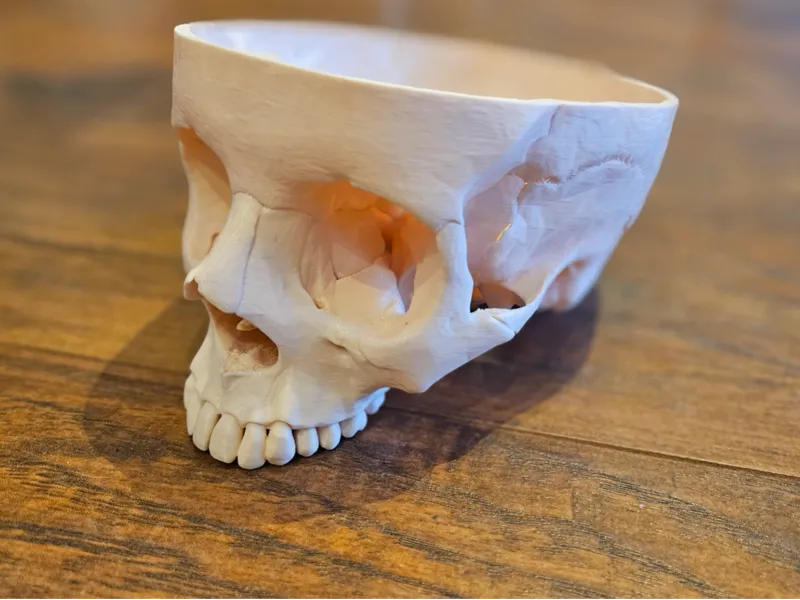 Segmented Human Skull for Anatomy Education