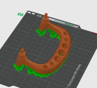 0.2mm layer, 2 walls, 15% infill