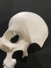 Fixed ringing