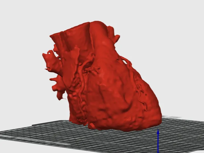 Real Heart from CT, 15% infill, detailed 1:1 scale