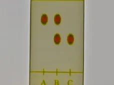 Aspirin TLC Plate – Lithophane Teaching Aid