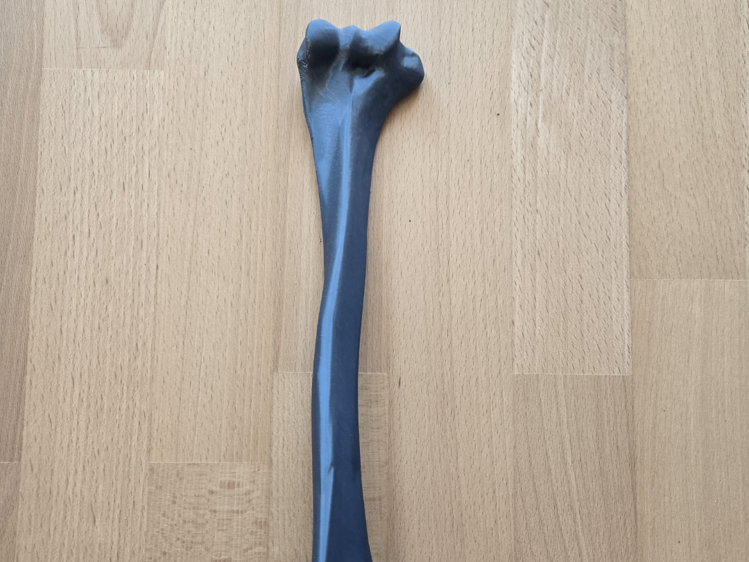 Humerus Bone (Left)