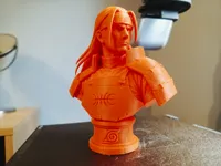 0.2mm layer, 3 walls, 15% infill