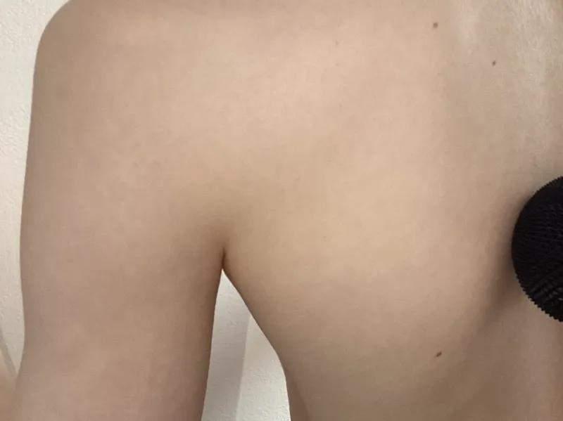 Small Acupressure Dome For Targeted Pain Relief