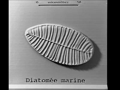 Diatom microphotography project