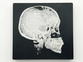 Anatomia X-Ray Realistica: Profilo Cranico