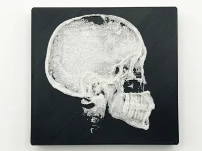 Realistic X-Ray Anatomy: Cranial Profile